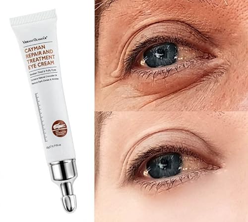 Say Goodbye to Eye Bags with the Best Eye Bag Removal Cream