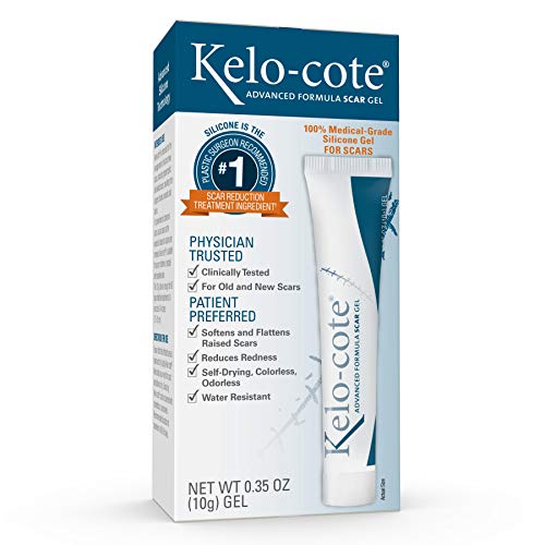 Keloid Scar Removal: Discover the Best Products for Flawless Skin!